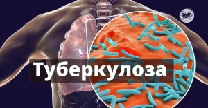 „Седмица на отворените врати“ и безплатни прегледи за туберкулоза започват в гр. Кюстендил в периода 14 -18 септември 2026 г. в часовия диапазон от 10.00 до 16.00 часа.